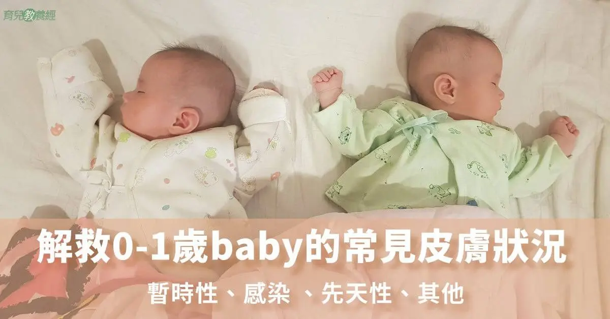 解救0-1歲baby的常見皮膚狀況