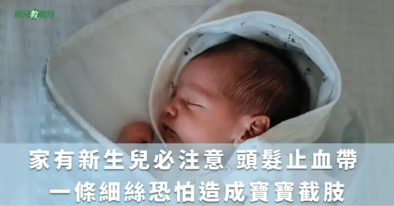 家有新生兒必注意 頭髮止血帶 一條細絲恐怕造成寶寶截肢