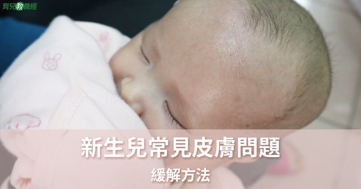 新生兒常見皮膚問題