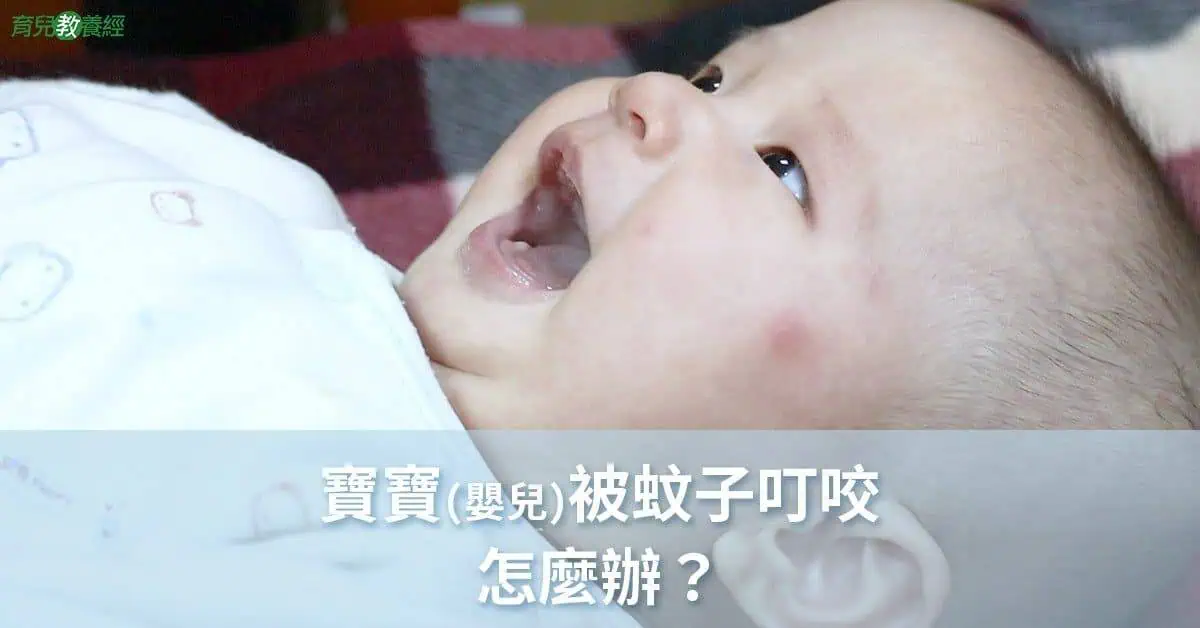寶寶被蚊子叮咬
