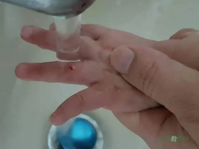使用ok繃前處理方式001