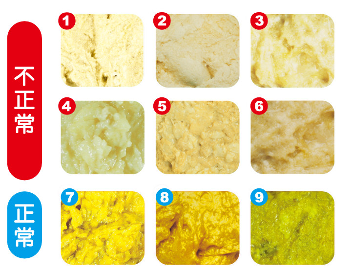 大便色卡